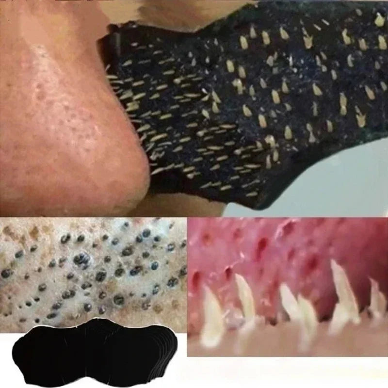 Mask removes blackheads